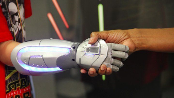 Des prothèses bioniques Iron Man, Star Wars et Disney pour enfants #3