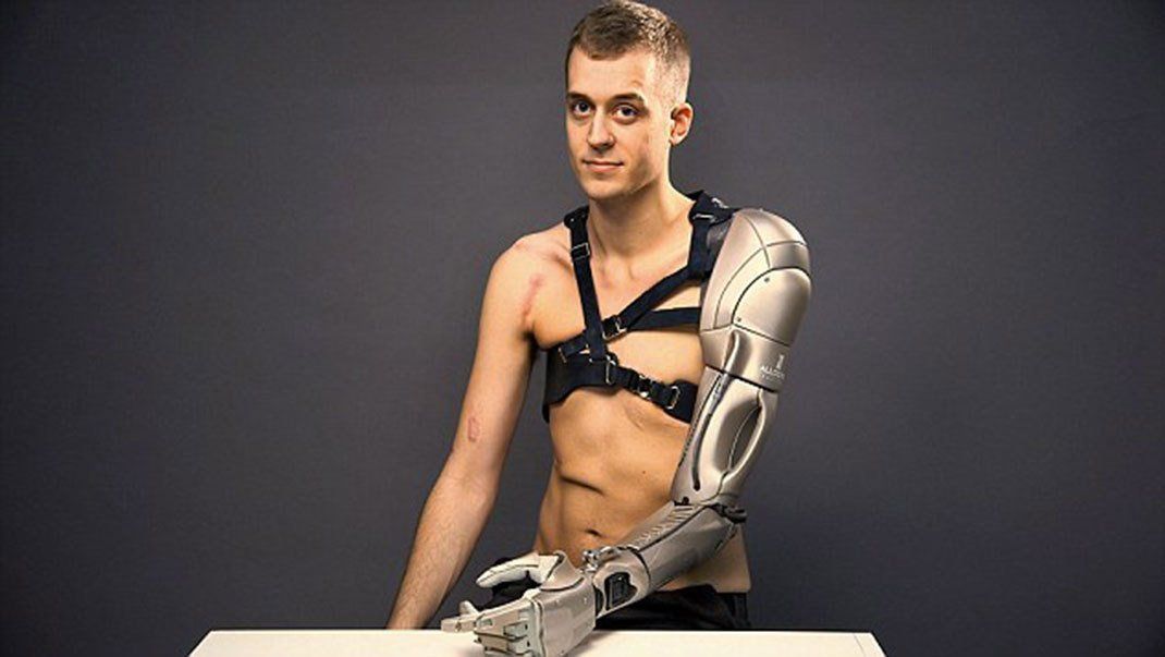 Konami greffe le bras bionique de Metal Gear Solid sur un amputé
