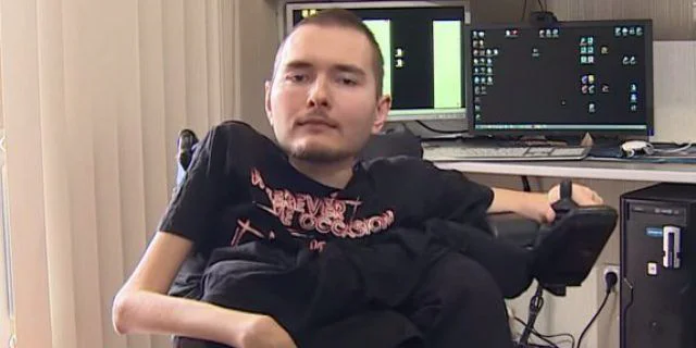Une greffe de tête va être pratiquée sur ce patient handicapé #3