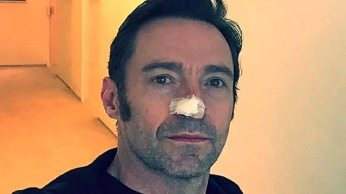 Hugh Jackman atteint d’un cancer de la peau vient de subir une nouvelle opération