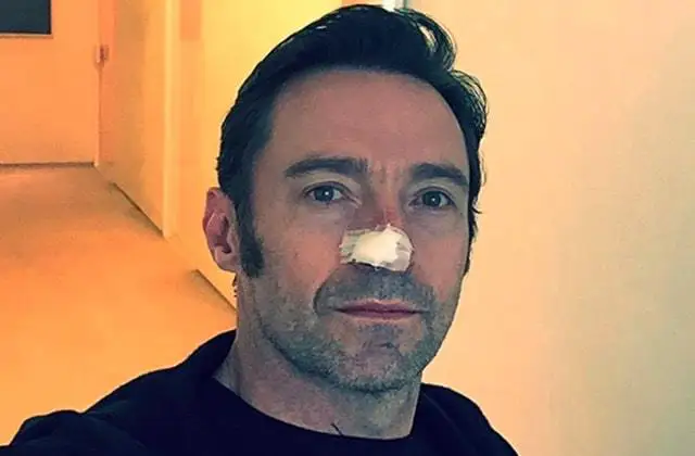 Hugh Jackman atteint d’un cancer de la peau vient de subir une nouvelle opération