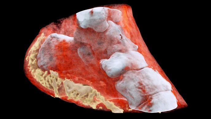 Des radiographies 3D couleurs d’un squelette humain impressionnantes #2