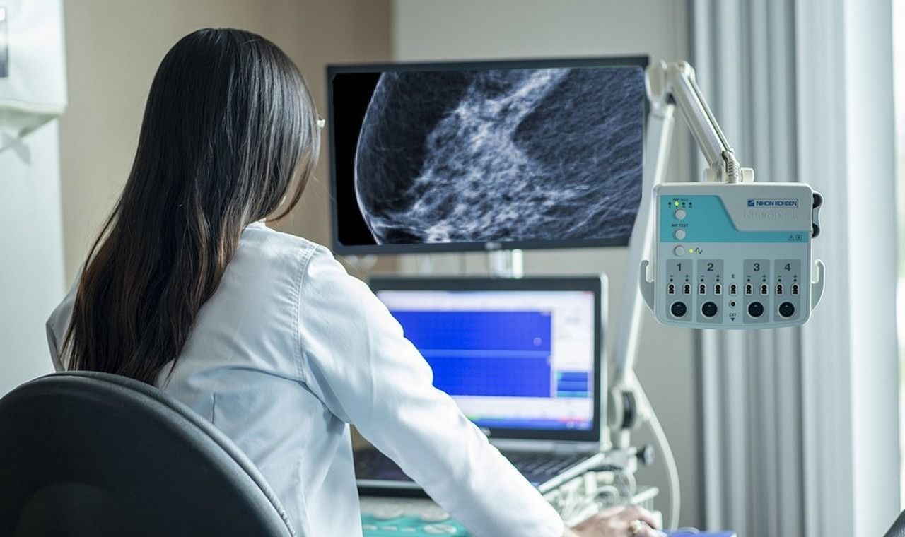 Cette IA peut prédire le cancer du sein 5 ans à l’avance