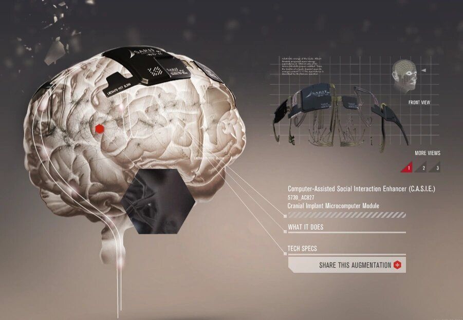 Neuralink : Elon Musk va présenter une puce qui rend plus intelligent et permet de connecter le cerveau aux machines #3