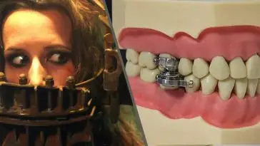 Des scientifiques imaginent un dispositif de perte de poids qui bloque la bouche