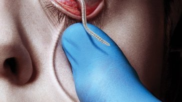 The Strain