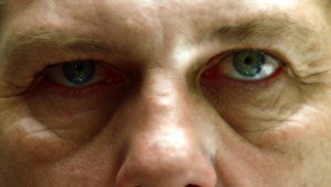 Dr House Saison 3 Episode 1