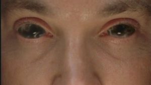 The X-Files Saison 3 Episode 15